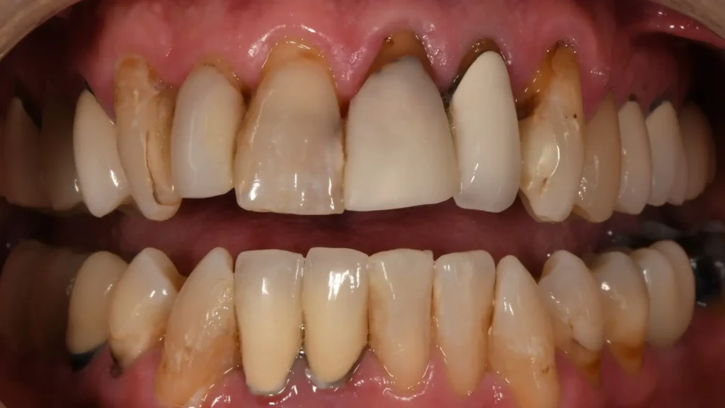 before work - bad teeth